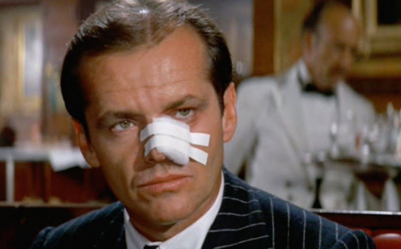 Najsłynniejszy opatrunek w historii kina – Jack Nicholson w filmie „Chinatown” Romana Polańskiego